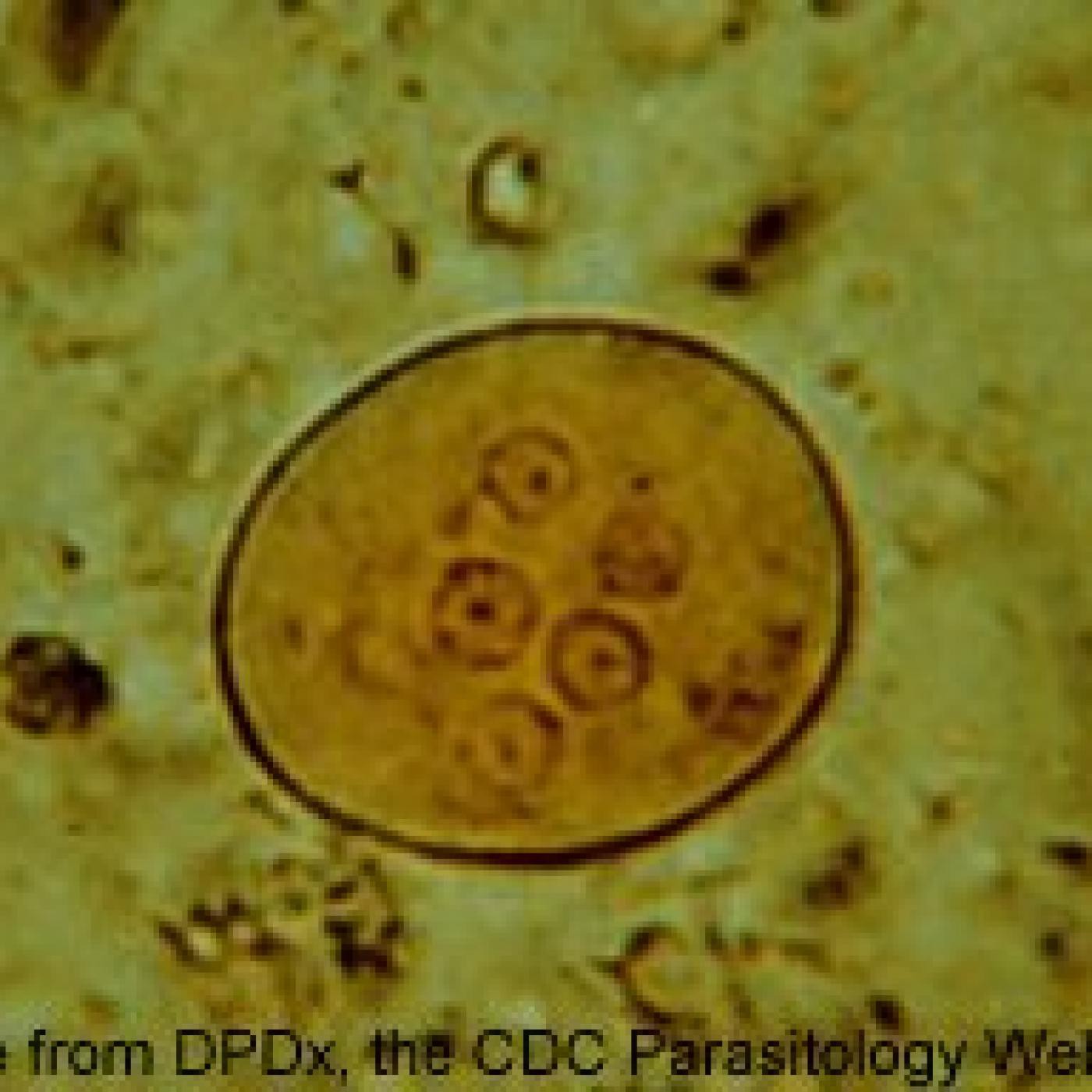 Простейшие в кале лечение. Entamoeba histolytica циста. Цисты кишечной амебы (Entamoeba coli). Микроскопия кала цисты амеба. Дизентерийная амеба в Кале.