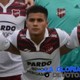 Yair arismendi, figura de douglas.