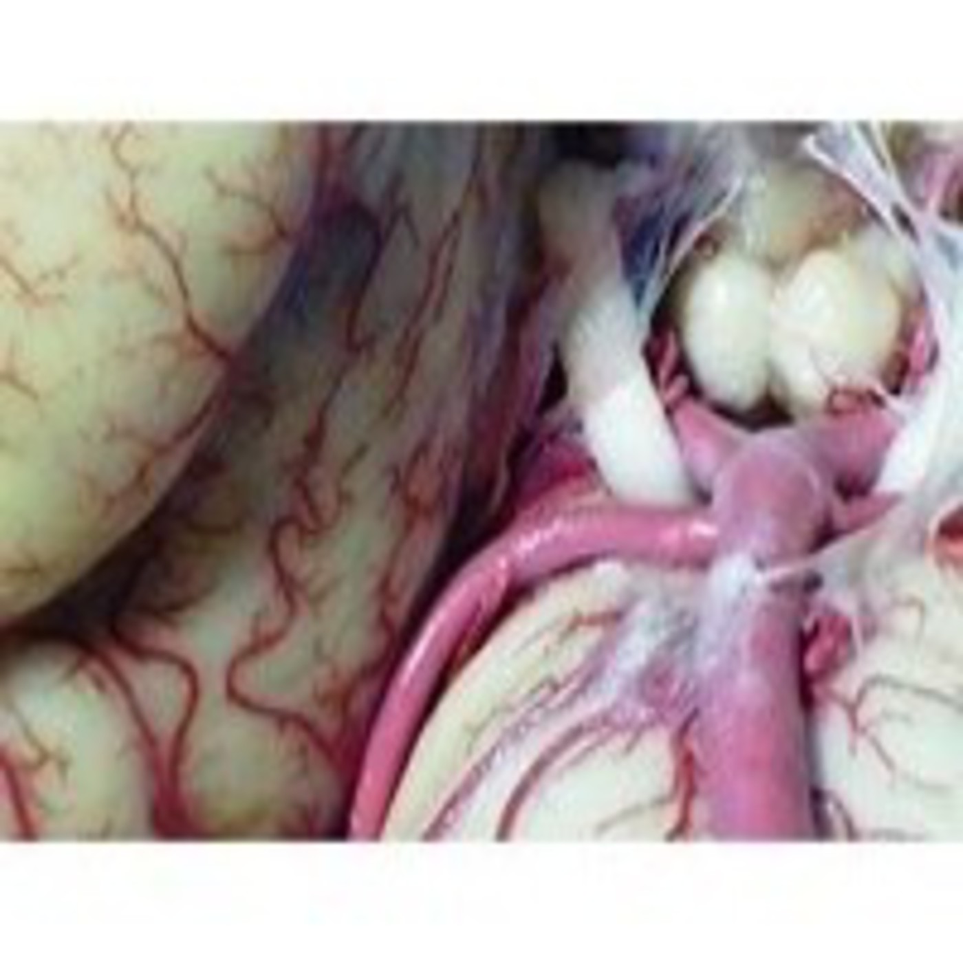 Anatomía del Corazón (8): Inervación sensitiva en Anatomía 